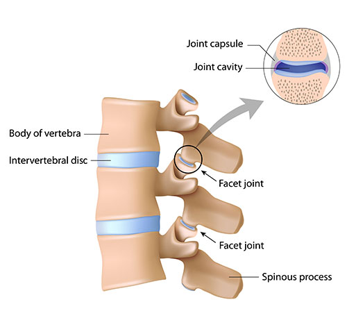 Neck Pain Symptoms, Causes & Treatments